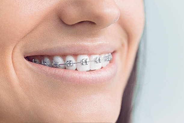 Best Dental Exams and Cleanings  in Alum Rock, CA